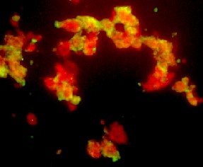 Venezuelan Equine Encephalitis Virus